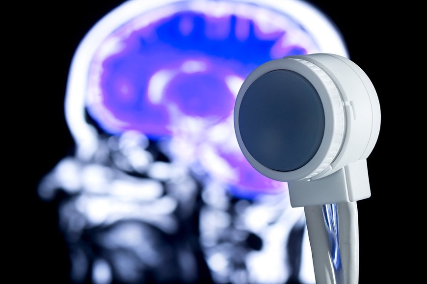 Brain stimulation with 3D ultrasound to treat neurological diseases and conditions